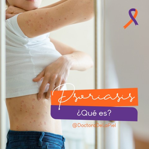 Psoriasis ¿Qué es?