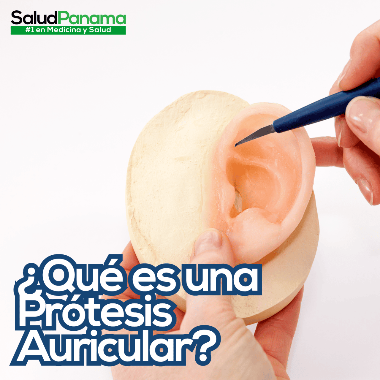 ¿Qué es una Prótesis Auricular?