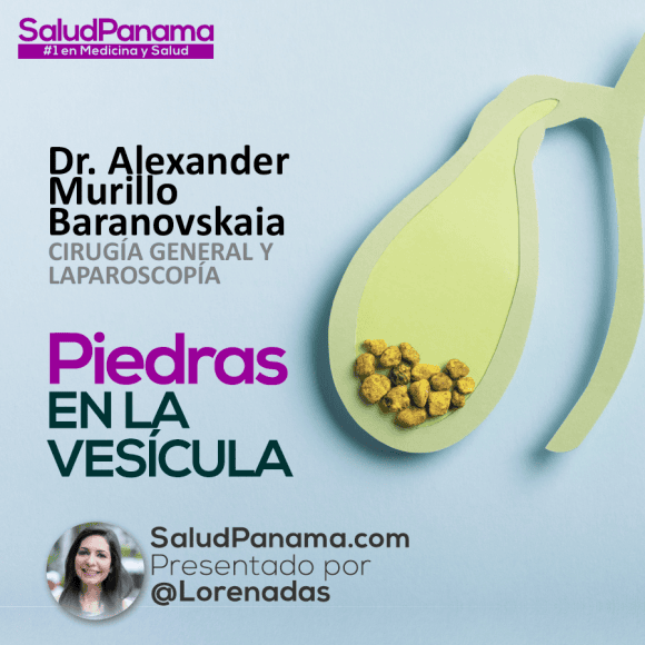Piedras en la Vesícula con Dr. Alexander Murillo Baranovskaia