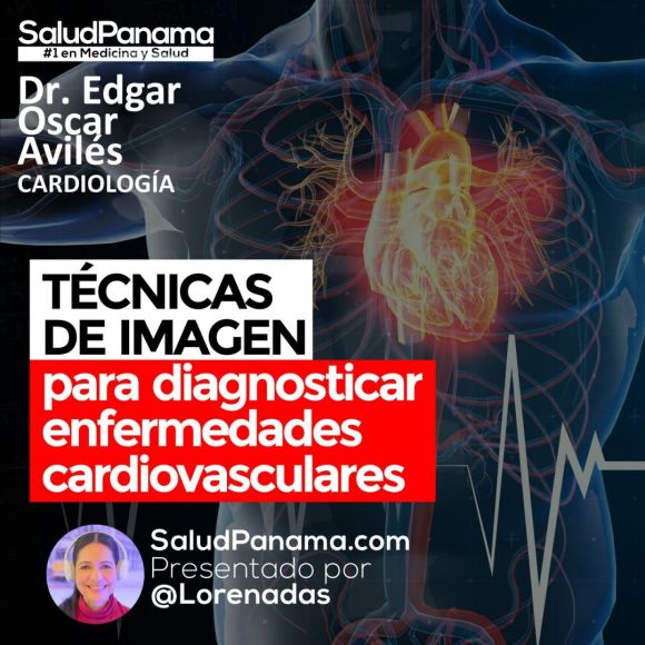 Técnicas de Imagen para diagnosticar enfermedades cardiovasculares