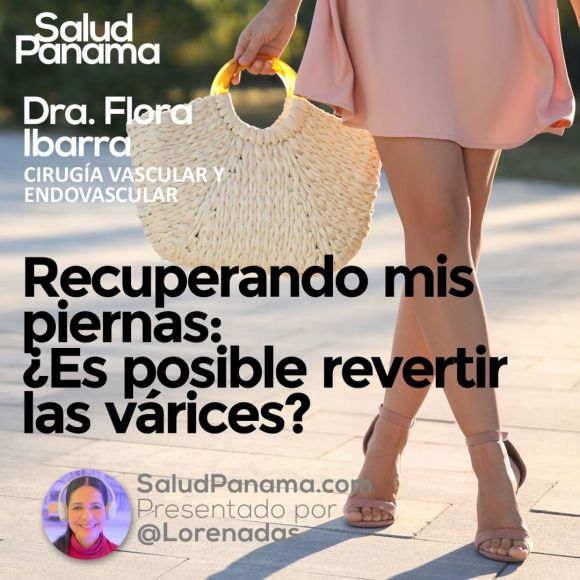 Recuperando mis piernas: ¿Es posible revertir las várices?