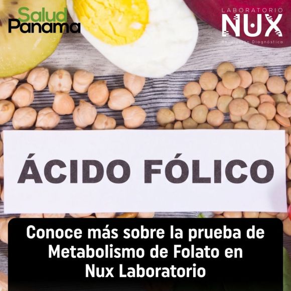 Prueba de Metabolismo de Folato de Nux Laboratorio