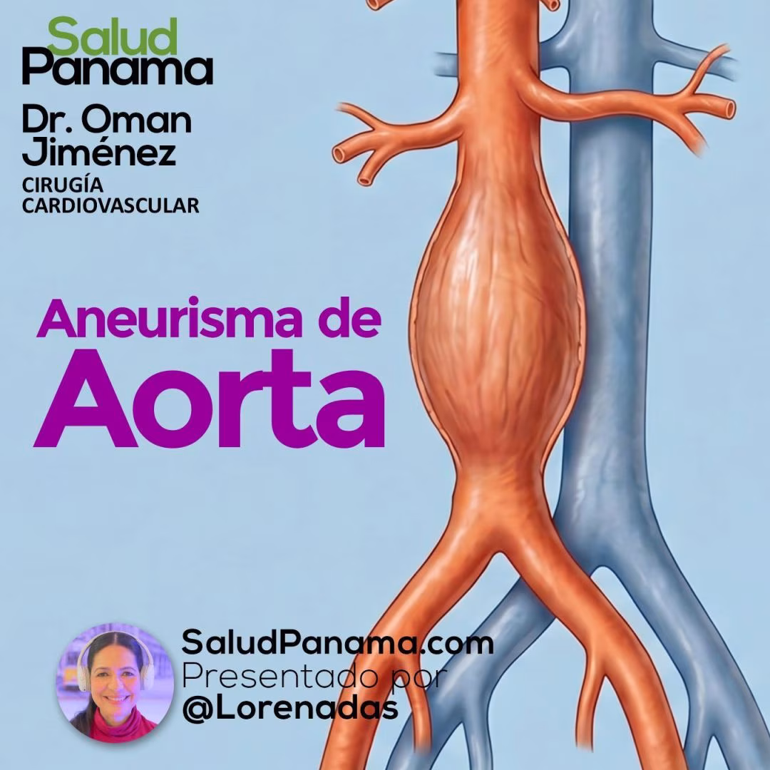 Aneurisma de aorta: una condición silenciosa que puede poner en riesgo la vida