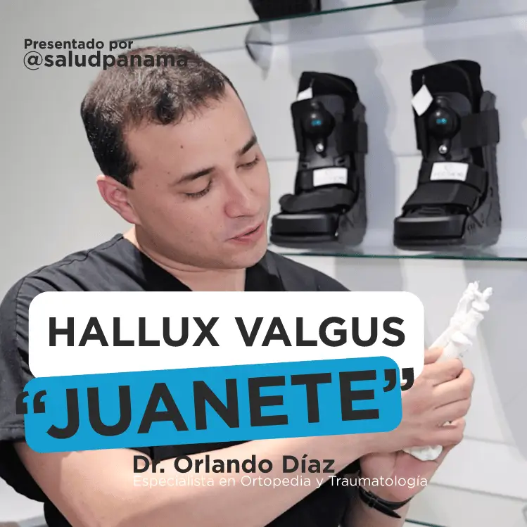 El Juanete o Hallux Valgus y sus Tratamientos en Panamá